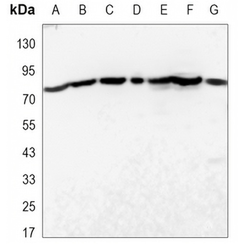 STAT3 Mouse Monoclonal Antibody(C3376)