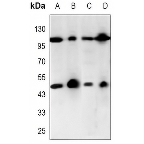 NF-kappaB p105 Mouse Monoclonal Antibody(C3377)