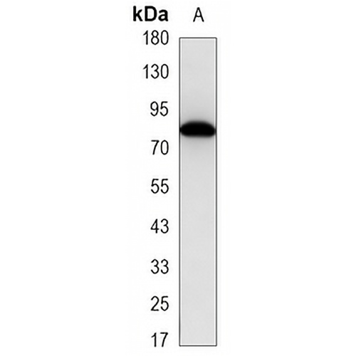 MMP2 Mouse Monoclonal Antibody(C3378)
