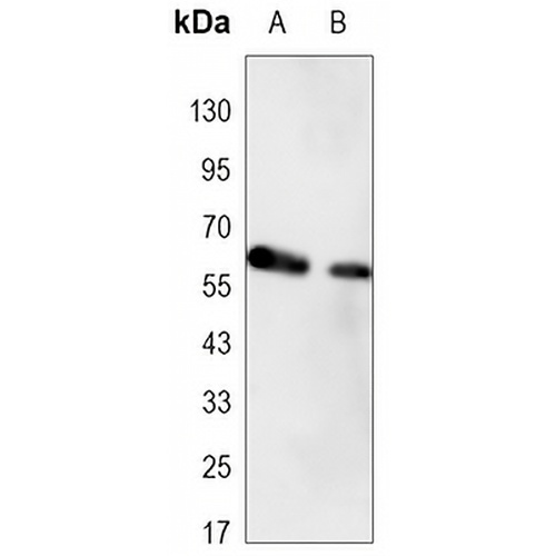 RNF52 Mouse Monoclonal Antibody(C3380)