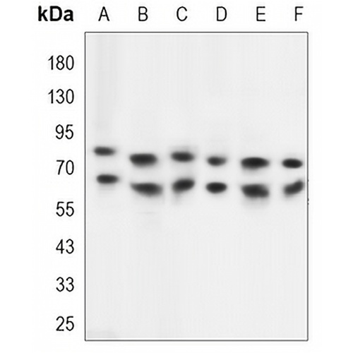 TAK1 Mouse Monoclonal Antibody(C3386)