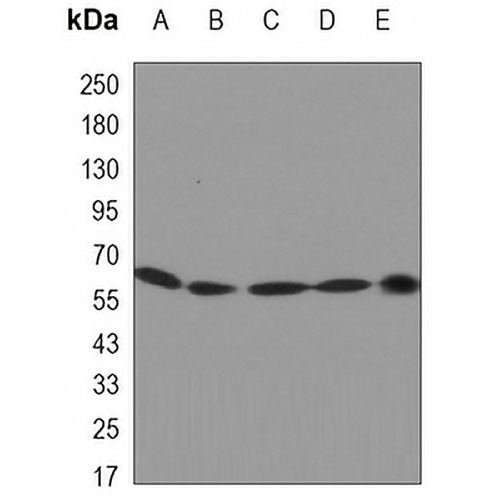 Cytokeratin 5 Mouse Monoclonal Antibody(C3390)