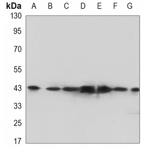 FEN1 Mouse Monoclonal Antibody(C3392)