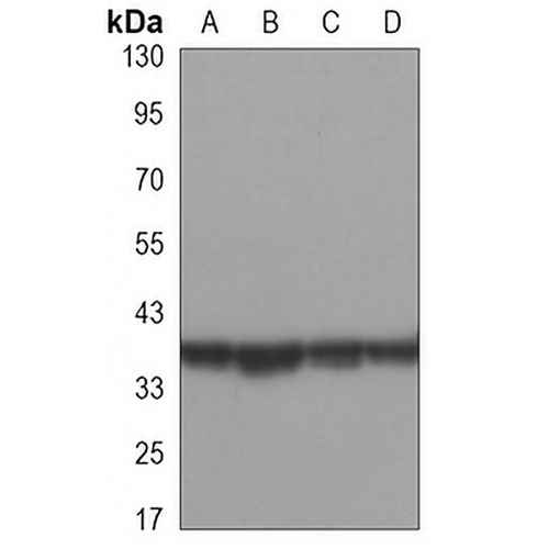 ERCC1 Mouse Monoclonal Antibody(C3396)