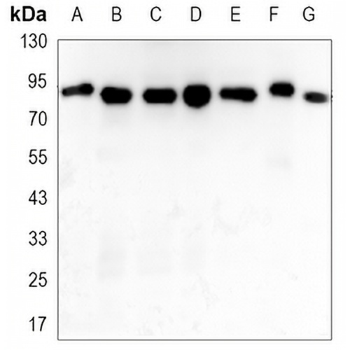 STAT5A Mouse Monoclonal Antibody(C3399)