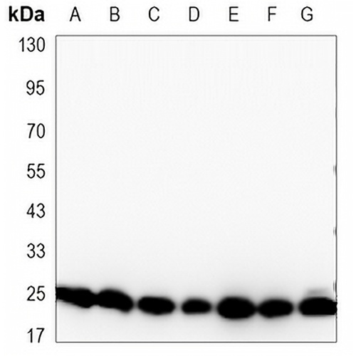 EIF4E Mouse Monoclonal Antibody(C3401)