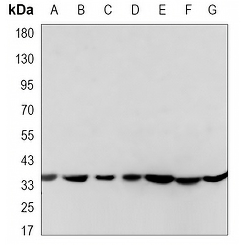EIF2S1 Mouse Monoclonal Antibody(C3402)