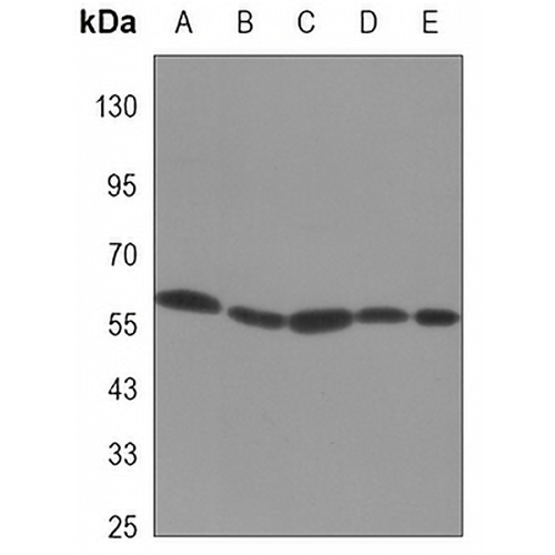 Vimentin Mouse Monoclonal Antibody(C3405)