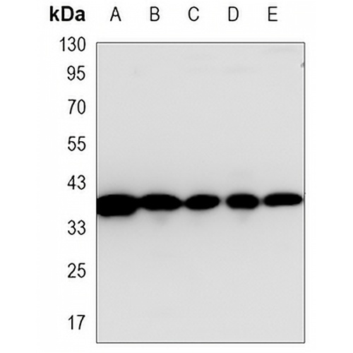 MKK6 Mouse Monoclonal Antibody(C3411)