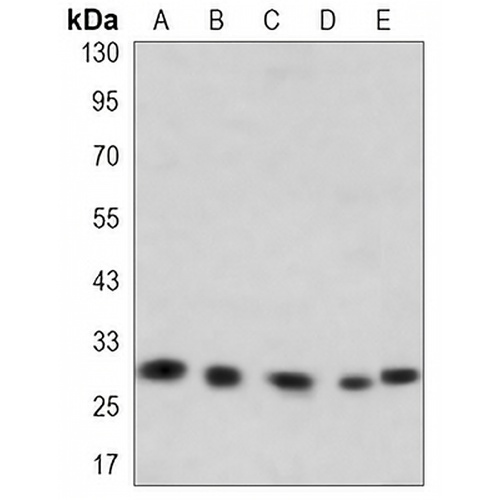 RPS6 Mouse Monoclonal Antibody(C3414)