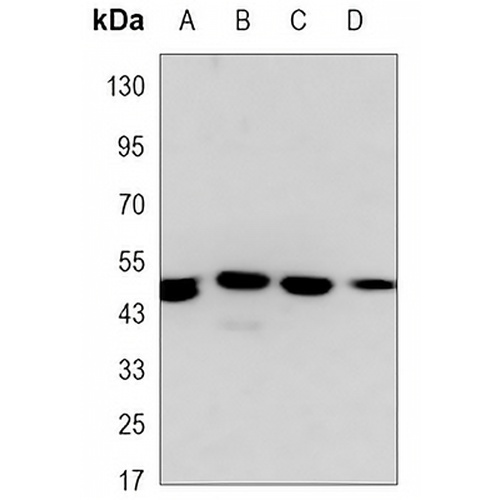 Lupus La Mouse Monoclonal Antibody(C3417)
