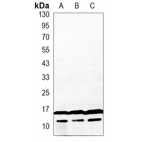 LC3A/B Mouse Monoclonal Antibody(C3422)