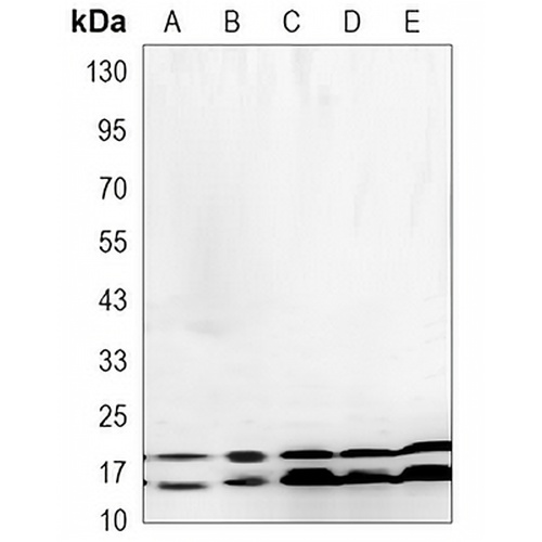 nm23-H1 Mouse Monoclonal Antibody(C3423)