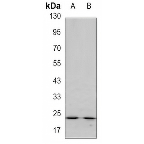 GSTP1 Mouse Monoclonal Antibody(C3429)
