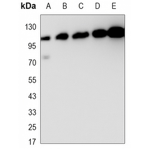 EPHB1 Mouse Monoclonal Antibody(C3431)