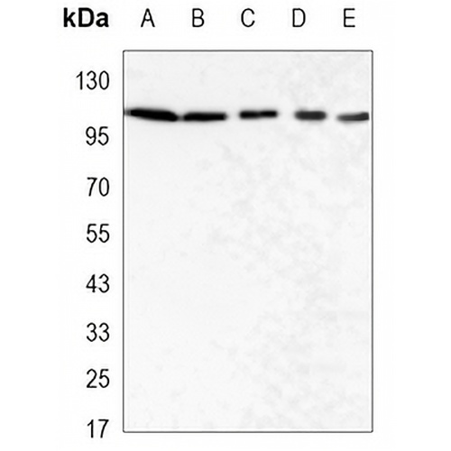PYK2 Mouse Monoclonal Antibody(C3432)