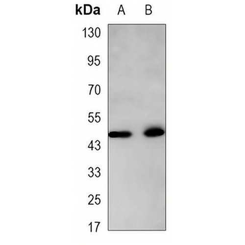 Cytokeratin 18 Mouse Monoclonal Antibody(C3434)