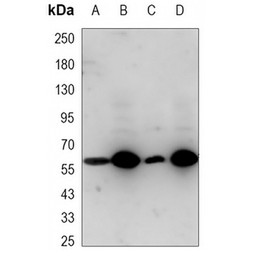 Metadherin Mouse Monoclonal Antibody(C3437)