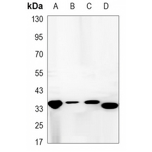 Synaptophysin Mouse Monoclonal Antibody(C3438)