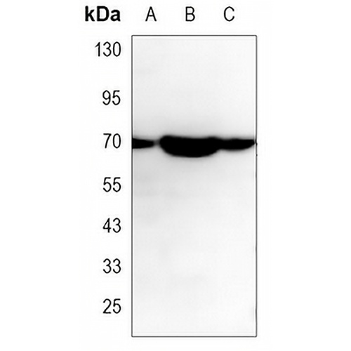 ALPP Mouse Monoclonal Antibody(C3439)