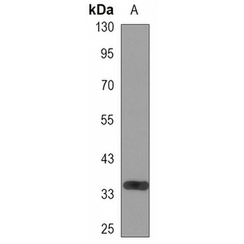 Kallikrein 3 Mouse Monoclonal Antibody(C3442)