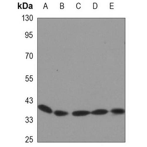 Beta-actin Mouse Monoclonal Antibody(C3445)