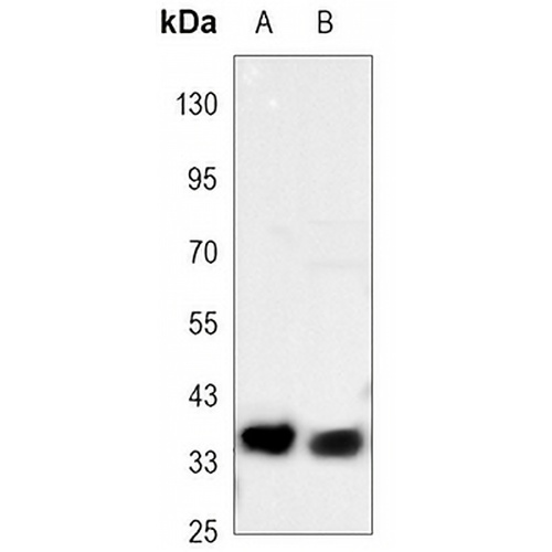 CD326 Mouse Monoclonal Antibody(C3449)