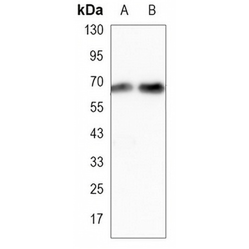 ALB Mouse Monoclonal Antibody(C3455)