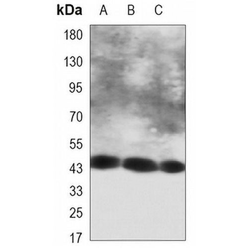 Cytokeratin 18 Mouse Monoclonal Antibody(C3458)