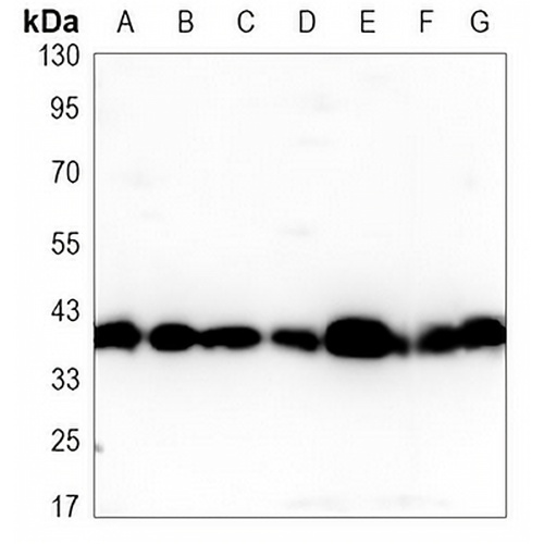 SIRT6 Mouse Monoclonal Antibody(C3460)