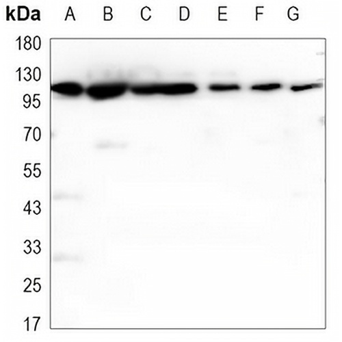 Hexokinase 1 Mouse Monoclonal Antibody(C3461)
