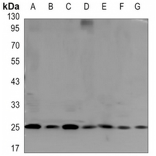 GRB2 Mouse Monoclonal Antibody(C3464)