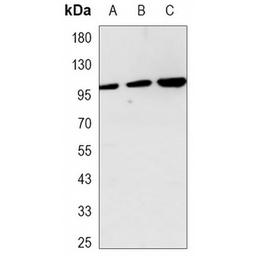 Hexokinase 2 Mouse Monoclonal Antibody(C3465)