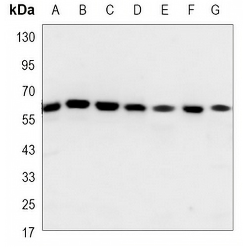 Histone Deacetylase 2 Mouse Monoclonal Antibody(C3466)