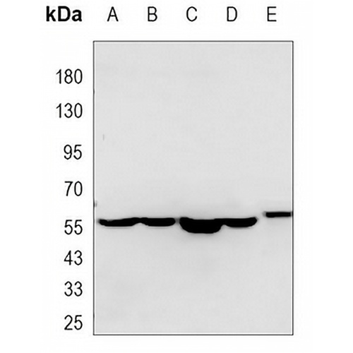Pyruvate Kinase Mouse Monoclonal Antibody(C3471)