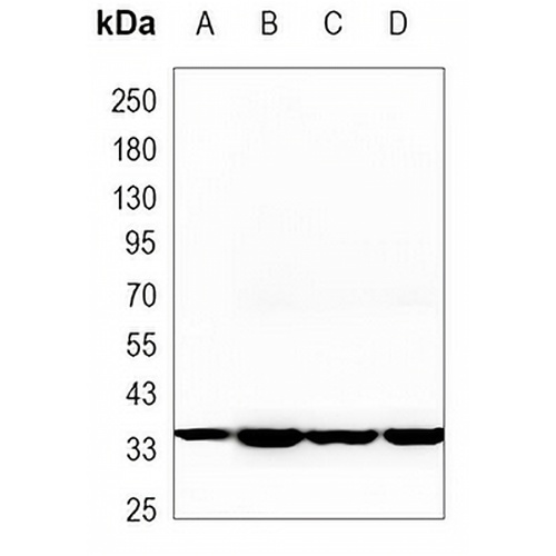 Aldose Reductase Mouse Monoclonal Antibody(C3472)