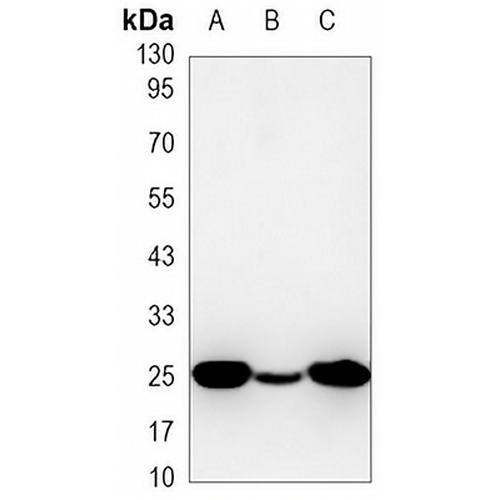 PGP9.5 Mouse Monoclonal Antibody(C3473)