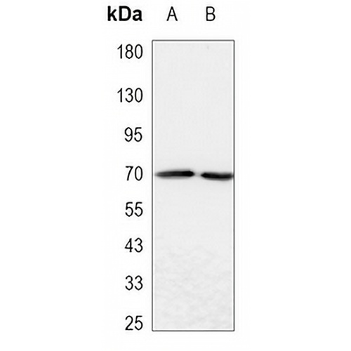 ALPP Mouse Monoclonal Antibody(C3475)
