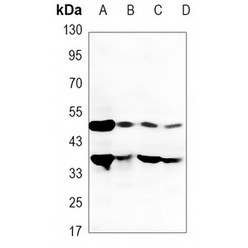 DR5 Mouse Monoclonal Antibody(C3476)