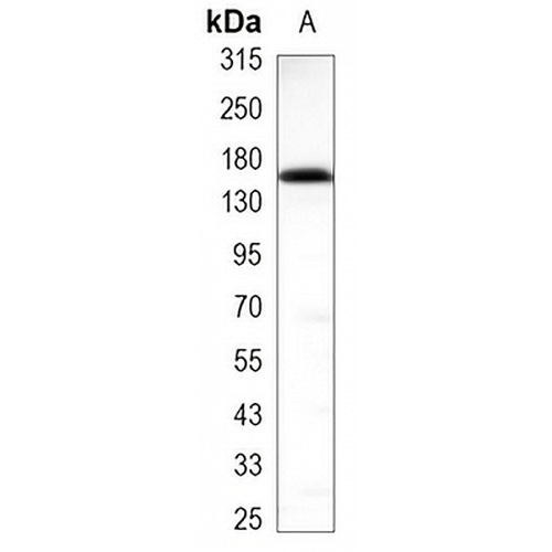 EGFR Mouse Monoclonal Antibody(C3485)