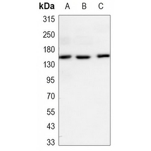 EGFR Mouse Monoclonal Antibody(C3486)