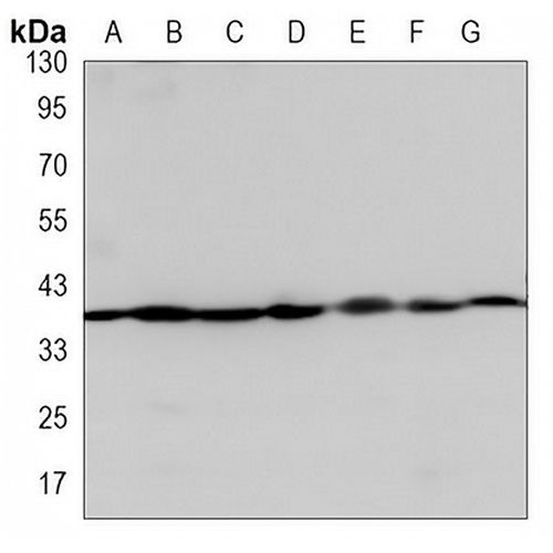 Annexin A1 Mouse Monoclonal Antibody(C3493)