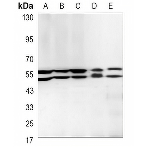 LYN Mouse Monoclonal Antibody(C3499)