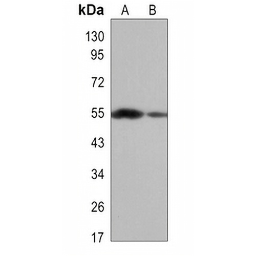 ALDH1A1 Rabbit Monoclonal Antibody(C3502)