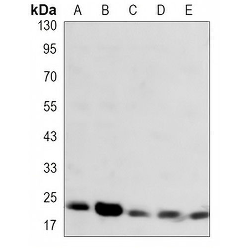 SOD2 Mouse Monoclonal Antibody(C3504)