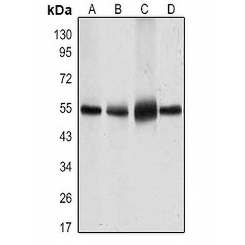 GLUT4 Mouse Monoclonal Antibody(C3505)