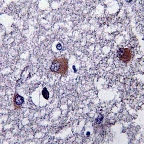 Beta Amyloid (1-42) Mouse Monoclonal Antibody(C3506)