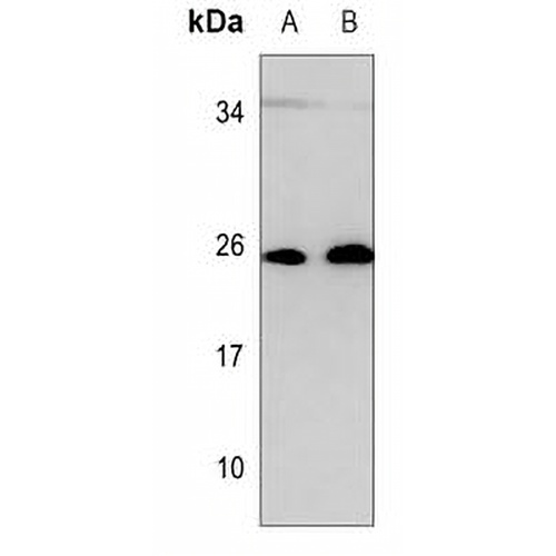 RAB27B Mouse Monoclonal Antibody(C3509)