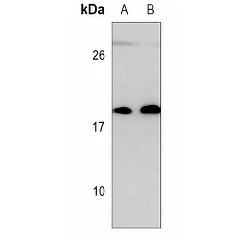 UBE2C Mouse Monoclonal Antibody(C3512)