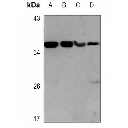 Pyridoxal Kinase Mouse Monoclonal Antibody(C3513)